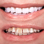 Cosmetic Dentistry